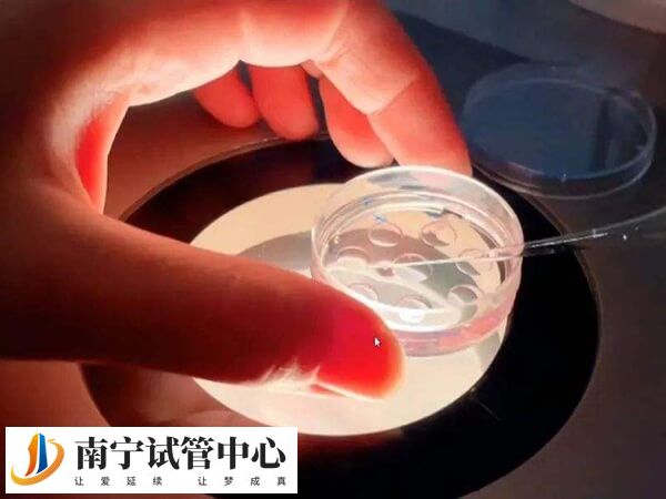 胚胎移植一枚