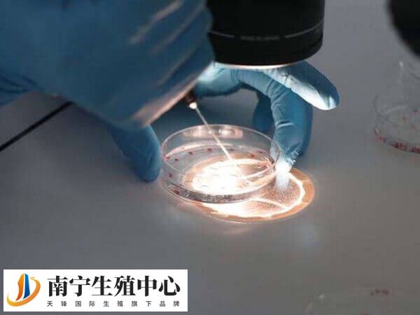 试管养囊要收费