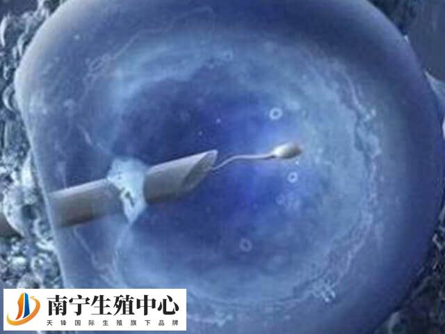 胚胎移植后要避免焦虑