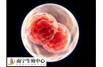 冻胚移植18天后尿频怎么回事
